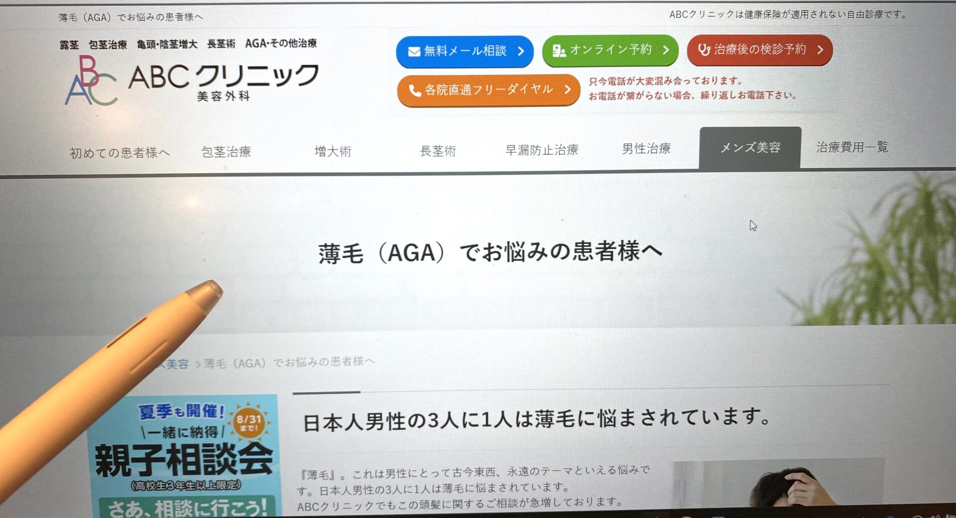 ABCクリニック薄毛画像