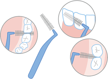 歯間ブラシの使い方